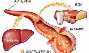 Статины для снижения холестерина: способы применения