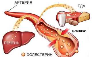 Статины для снижения холестерина: способы применения