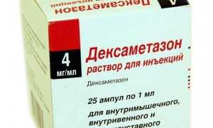 Дексаметазон при беременности: способы применения