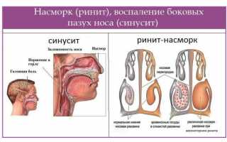 Чем лечить густые сопли у детей и взрослых