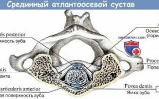 Атлантозатылочный сустав: что это, анатомия и характеристика