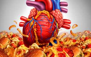 Атеросклероз сосудов сердца — что это за болезнь и как ее лечить?