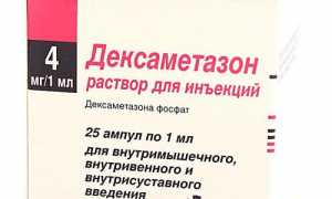 Как колоть внутримышечно смесь дексаметазона с лидокаином и витамином В12