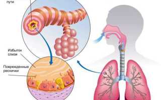 Что такое острый и хронический трахеобронхит и как его лечить у детей и взрослых