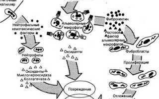 Продолжительность жизни при фиброзе легких