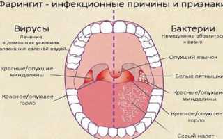 Почему першит горло и как быстро вылечиться в домашних условиях?