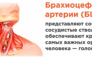 Атеросклероз брахиоцефальных артерий (БЦА)