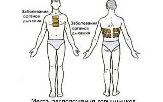 Нужно ли при бронхите применять горчичники и как их правильно ставить взрослому и ребенку