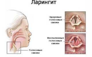 Лечение кашля сиропом Доктор Тайсс с подорожником: обзор инструкции и отзывов о применении