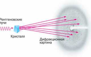 Что показывает рентген органов грудной клетки, где и как часто его можно делать?