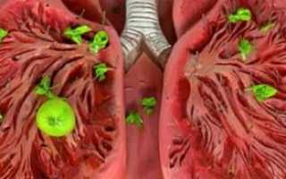 Почему откашливается зеленая мокрота и насколько это опасно у взрослых и детей?