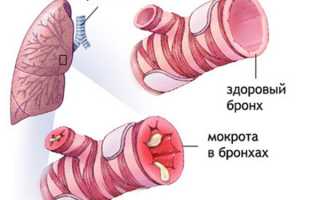 Лечение кашля препаратом Суприма-Бронхо: обзор инструкции и отзывов о применении детьми и взрослыми