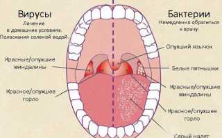 Как применять таблетки для рассасывания Гексализ?