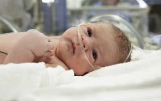 Последствия асфиксии у новорожденных