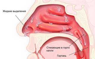Почему идут жёлтые сопли и как их правильно лечить у взрослого человека