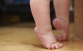 Синдром пирамидной недостаточности в ногах у детей