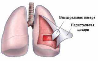 Плеврит лёгких — что это такое и как с ним бороться?