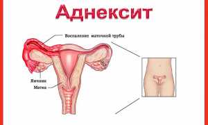 Лечение воспаления придатков Метронидазолом, Доксициклином и Азитромицином