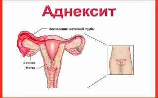 Лечение воспаления придатков Метронидазолом, Доксициклином и Азитромицином