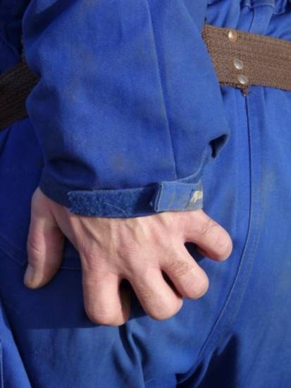 Зуд в заднем проходе Зуд в заднем проходе