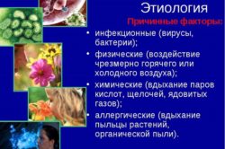 Возможные причины появления фарингита Возможные причины появления фарингита