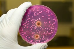 Бактериея Salmonella Бактериея Salmonella