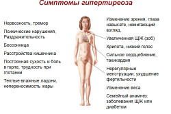 Симптомы гипертиреоза Симптомы гипертиреоза
