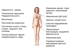 Проявления гипертиреоза Проявления гипертиреоза
