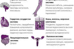 Проявления гипертиреоза Проявления гипертиреоза