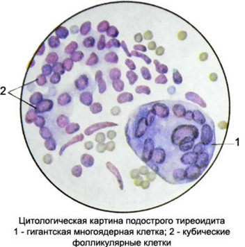 цитологическая картина болезни